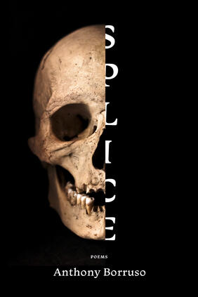 Splice by Anthony Borruso